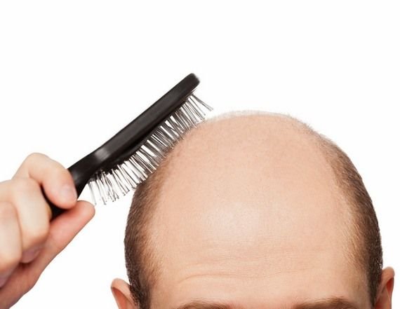 Informazioni sulla caduta dei capelli